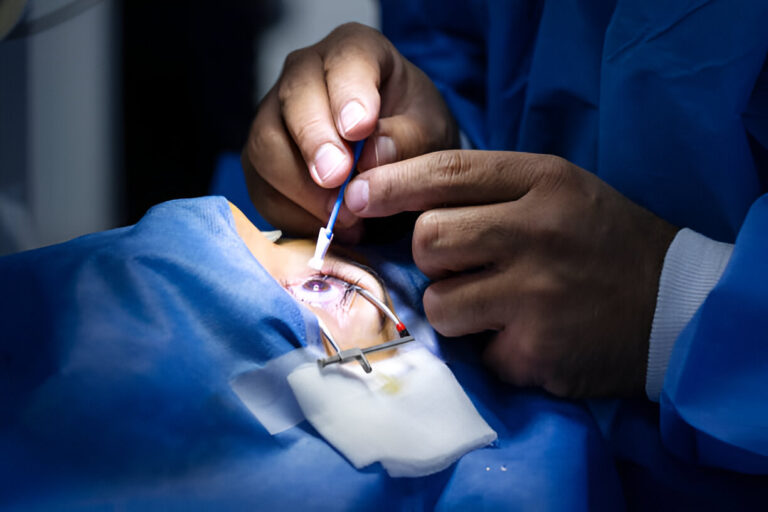 The Surprising Benefits of LASIK Eye Surgery for Modern Living