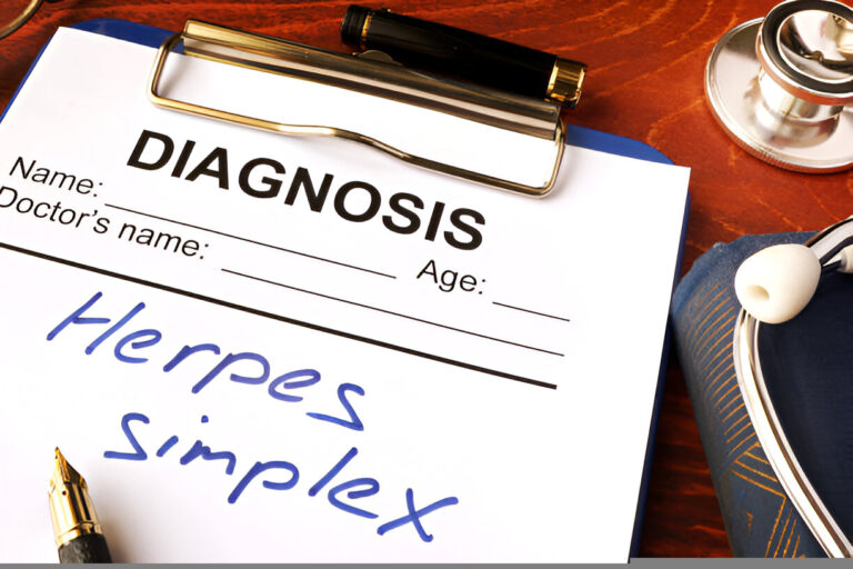 Right Herpes Treatment Strategy
